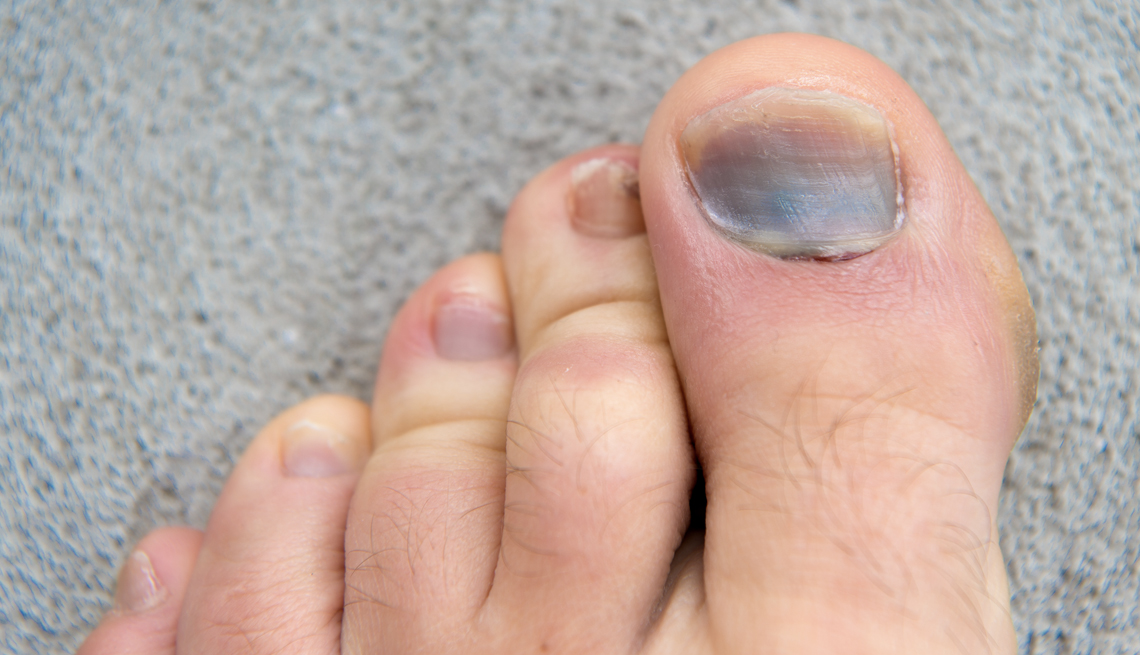 What is happening to my toenails?: Peachstate Advanced Cardiac
