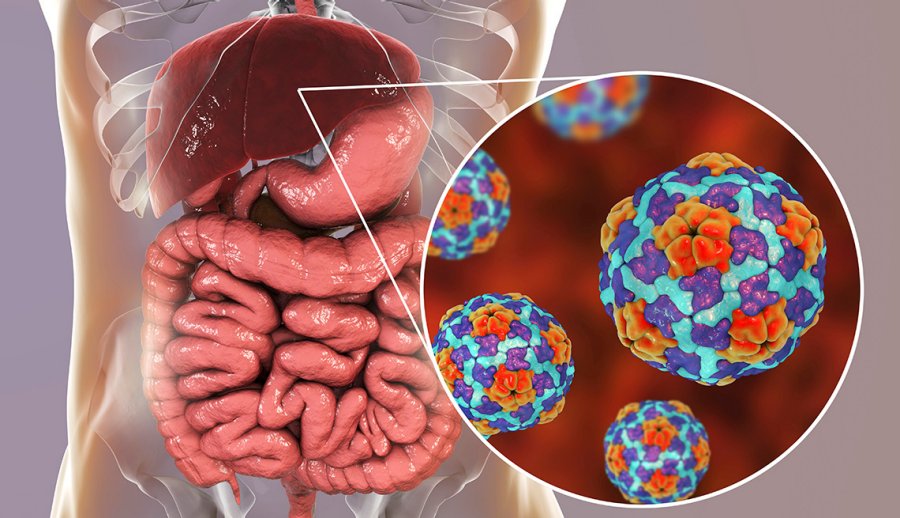 How To Protect Yourself From Rising Hepatitis A Risk