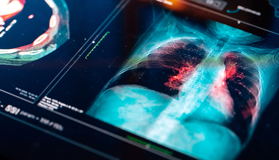 Imagen de una resonancia magnética de un torso de una persona