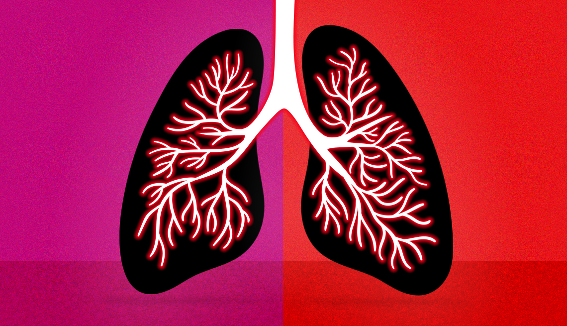 Ilustración de unos pulmones inflamados