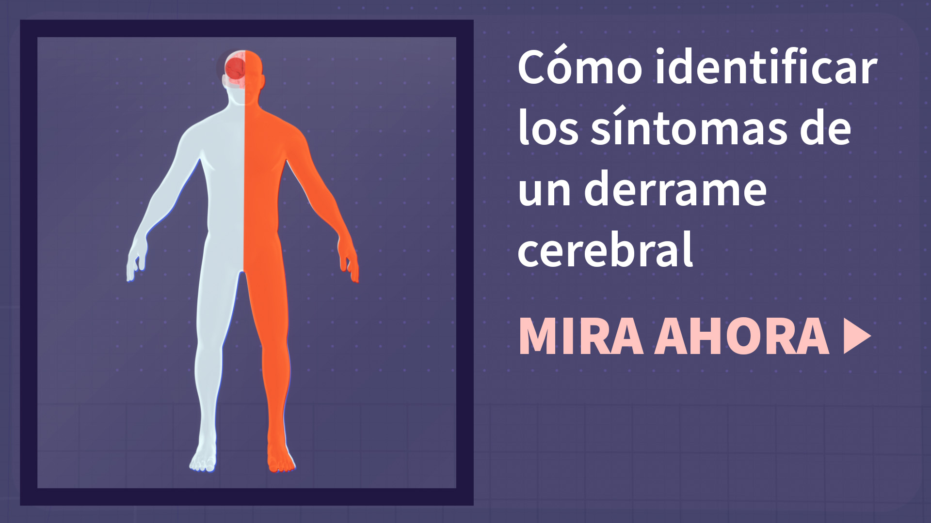 Identificar síntomas de un derrame